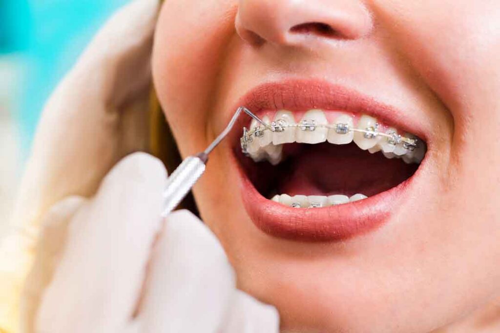 west end dental dundee, orthodontic treatment