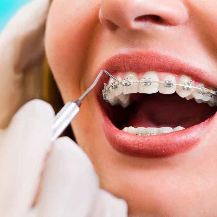 west end dental dundee, orthodontic treatment